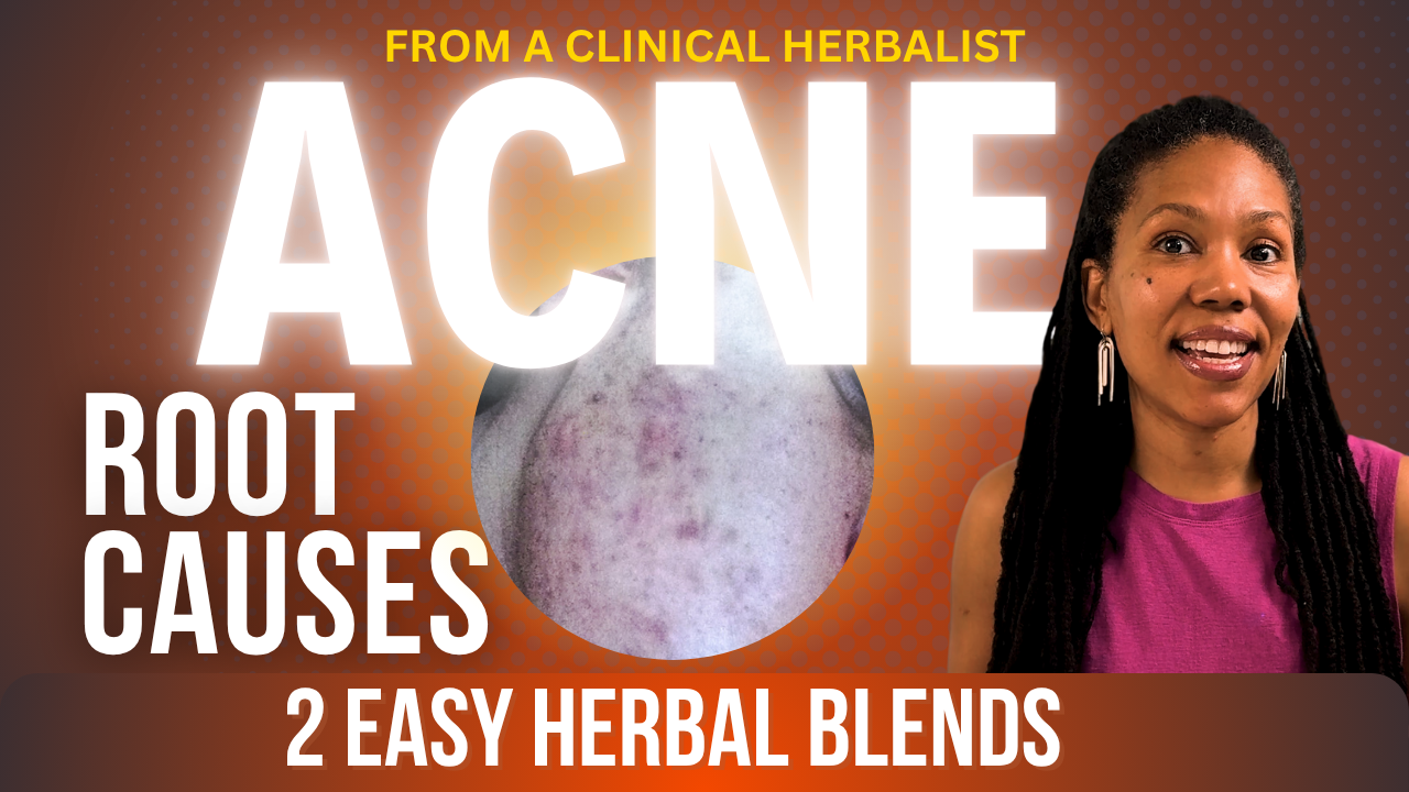 Why Your Acne Isn’t Just a Skin Issue (And How Herbs Can Help)